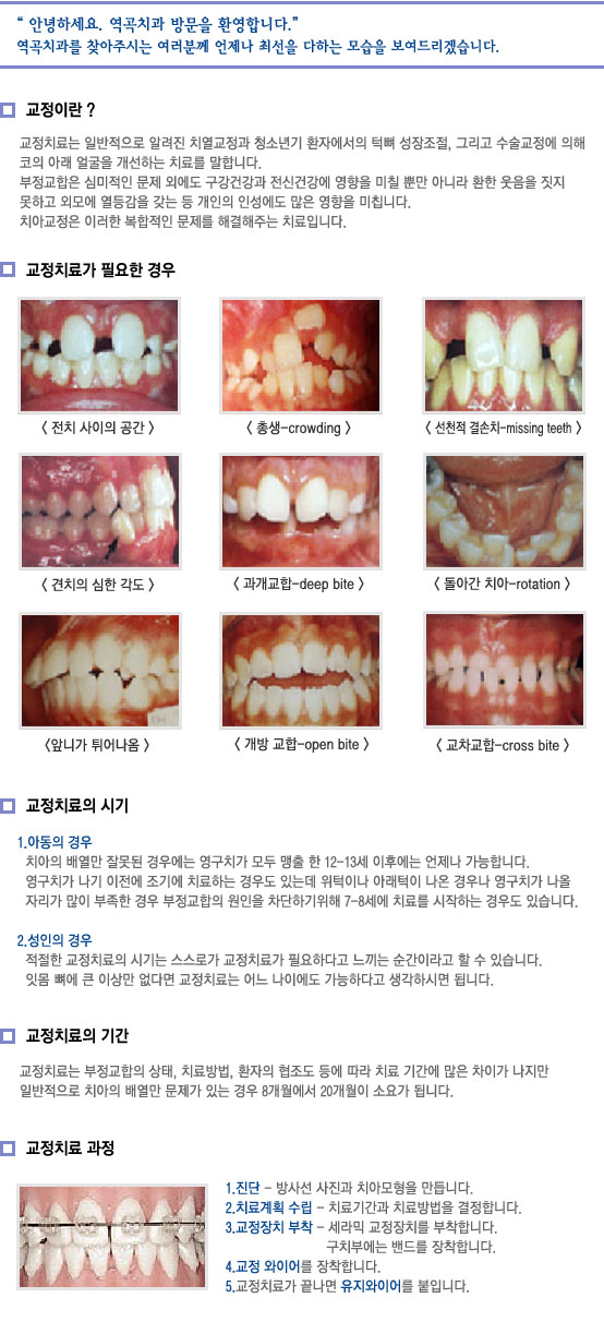 치아교정